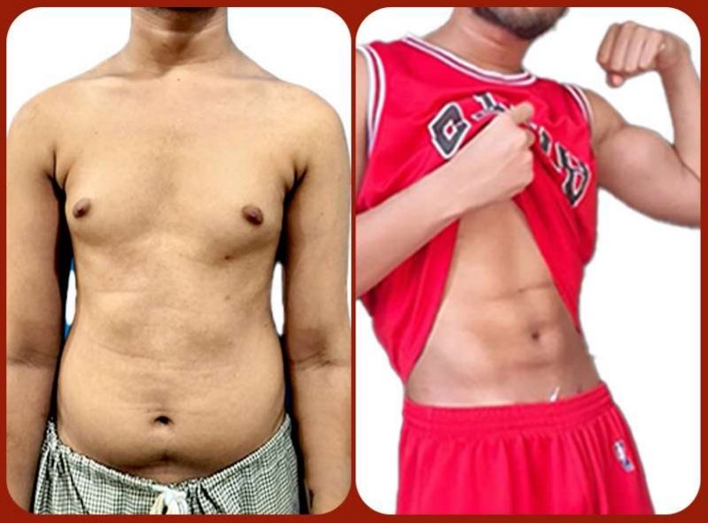 Before and after: Six-Pack Abs