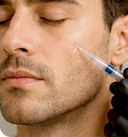 Microneedling