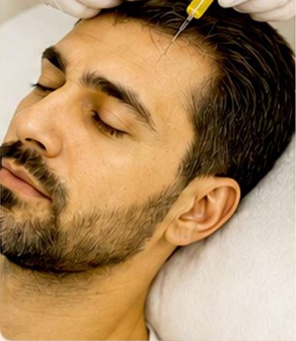 PRP / GFC Hair Therapy