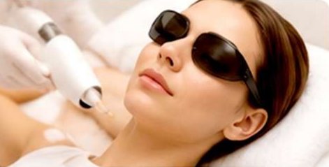 Laser Hair Reduction