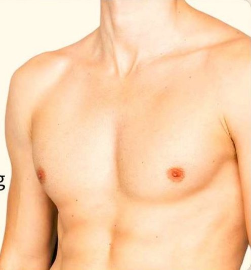 Chest Packs