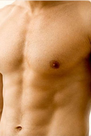 Gynecomastia Surgery