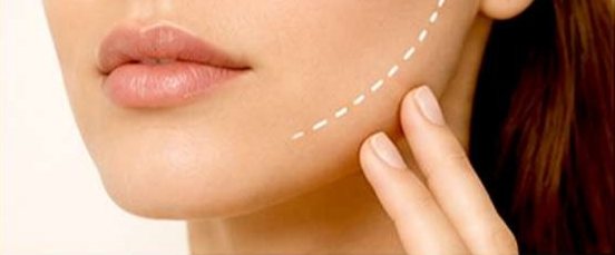 Buccal Fat Removal