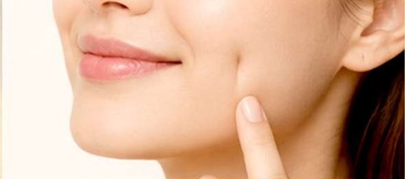 Dimple Creation