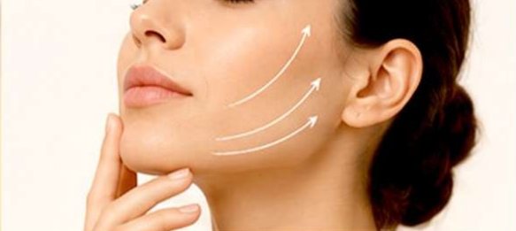 Face Lift (Rhytidectomy)