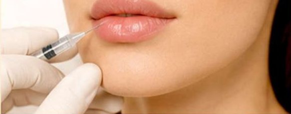 Lip Surgery (Augmentation)